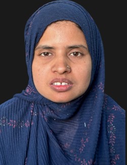 After Direct Composite Buildup